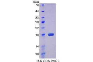 SDS-PAGE analysis of Mouse Preprovasopressin Protein. (Preprovasopressin Protein)
