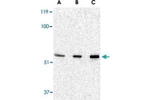 Western blot analysis of PAK2 in Jurkat lysate with PAK2 polyclonal antibody  at (A) 0. (PAK2 antibody  (N-Term))