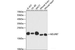 Western blot analysis of extracts of various cell lines using NDUFB7 Polyclonal Antibody at dilution of 1:3000. (NDUFB7 antibody)