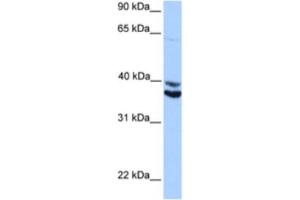 Western Blotting (WB) image for anti-MyoD Family Inhibitor Domain Containing (MDFIC) antibody (ABIN2463382)