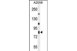 C6orf70 Antibody (Center) (ABIN654987 and ABIN2844625) western blot analysis in  cell line lysates (35 μg/lane). (C6orf70 antibody  (AA 346-375))
