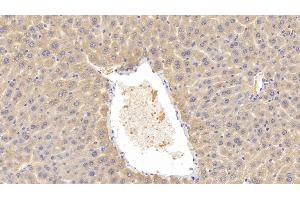 Detection of LCAT in Mouse Liver Tissue using Polyclonal Antibody to Lecithin Cholesterol Acyltransferase (LCAT) (LCAT antibody  (AA 290-432))
