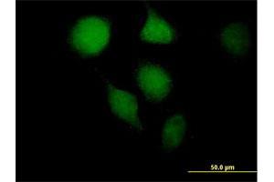 Immunofluorescence of purified MaxPab antibody to OGG1 on HeLa cell. (OGG1 antibody  (AA 1-324))
