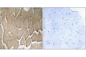 Immunohistochemistry analysis of paraffin-embedded human skeletal muscle, using RAB34 Antibody. (RAB34 antibody  (AA 206-255))