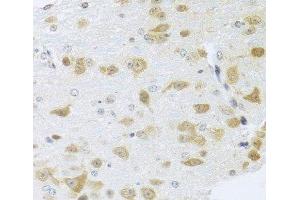 Immunohistochemistry of paraffin-embedded Mouse brain using Gm13125 Polyclonal Antibody at dilution of 1:100 (40x lens). (Pramel15 antibody)