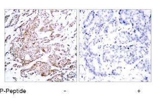 Image no. 1 for anti-Myc Proto-Oncogene protein (MYC) (pThr58) antibody (ABIN196672) (c-MYC antibody  (pThr58))