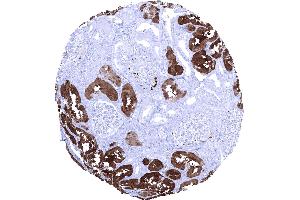 Kidney cortex In the kidney FABP1 immunostaining preferentially occurs in proximal tubuli (FABP1 antibody  (AA 1-127))