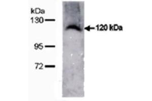 Image no. 4 for anti-Transmembrane Protein 67 (TMEM67) (C-Term) antibody (ABIN347657) (TMEM67 antibody  (C-Term))