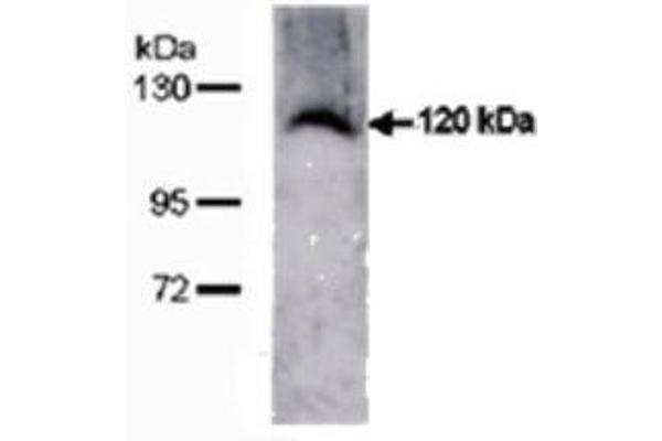 TMEM67 antibody  (C-Term)