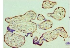 Immunohistochemistry of paraffin-embedded human placenta tissue using ABIN7167786 at dilution of 1:100 (RBBP5 antibody  (AA 319-538))