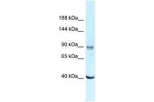 Image no. 1 for anti-DEAD (Asp-Glu-Ala-Asp) Box Polypeptide 23 (DDX23) (AA 662-711) antibody (ABIN6747808) (DDX23 antibody  (AA 662-711))