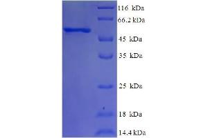 SDS-PAGE (SDS) image for Eukaryotic Translation Initiation Factor 3, Subunit G (EIF3G) (AA 2-320) protein (His-SUMO Tag) (ABIN5709453) (EIF3G Protein (AA 2-320) (His-SUMO Tag))