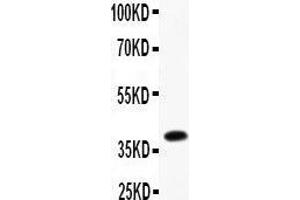 Anti- Caveolin-2 picoband antibody, Western blotting All lanes: Anti Caveolin-2  at 0.