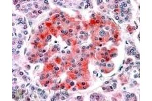 Image no. 2 for anti-Potassium Inwardly-Rectifying Channel, Subfamily J, Member 11 (KCNJ11) (Internal Region), (N-Term) antibody (ABIN374930) (KCNJ11 antibody  (Internal Region, N-Term))