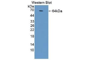 Detection of Recombinant MyD88, Rat using Polyclonal Antibody to Myeloid Differentiation Factor 88 (MyD88) (MYD88 antibody  (AA 1-296))