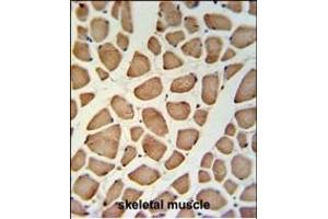 GPSN2 Antibody (C-term) (ABIN653745 and ABIN2843047) IHC analysis in formalin fixed and paraffin embedded skeletal muscle followed by peroxidase conjugation of the secondary antibody and DAB staining. (TECR antibody  (C-Term))