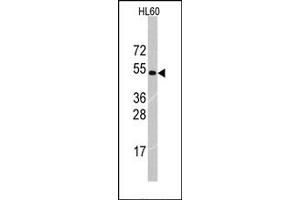 Image no. 1 for anti-Tripartite Motif Containing 69 (TRIM69) (Middle Region) antibody (ABIN357769) (TRIM69 antibody  (Middle Region))