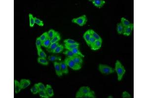 Immunofluorescence staining of HepG2 cells with ABIN7169920 at 1:166, counter-stained with DAPI. (SCN11A antibody  (AA 403-551))