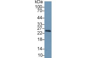 Western Blot; Sample: Mouse Kidney lysate; Primary Ab: 1µg/ml Rabbit Anti-Mouse RBP4 Antibody Second Ab: 0.