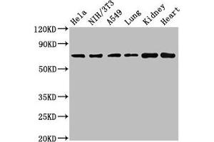 Western Blot Positive WB detected in: Hela whole cell lysate, NIH/3T3 whole cell lysate, A549 whole cell lysate, Rat lung tissue, Rat kidney tissue, Mouse heart tissue All lanes: ARHGAP18 antibody at 4. (ARHGAP18 antibody  (AA 389-577))