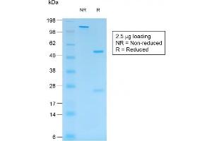 SDS-PAGE Analysis Purified S100B Mouse Recombinant Monoclonal Antibody (rS100B/1012). (Recombinant S100B antibody)
