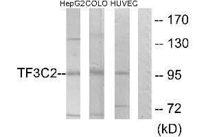 Western blot analysis of extracts from HepG2 cells, COLO205 cells and HUVEC cells, using TF3C2 antibody.