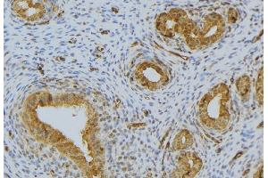 ABIN6276486 at 1/100 staining Human uterus tissue by IHC-P. (RNASE12 antibody  (Internal Region))
