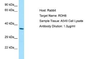 Western Blotting (WB) image for anti-Retinol Dehydrogenase 8 (RDH8) (Middle Region) antibody (ABIN2790129) (RDH8 antibody  (Middle Region))