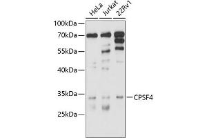 Western blot analysis of extracts of various cell lines, using CPSF4 antibody (ABIN6130128, ABIN6138972, ABIN6138973 and ABIN6214478) at 1:1000 dilution. (CPSF4 antibody  (AA 1-244))