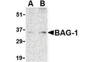 Western Blotting (WB) image for anti-BCL2-Associated Athanogene (BAG1) (N-Term) antibody (ABIN2477577) (BAG1 antibody  (N-Term))