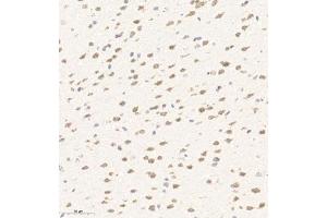 Immunohistochemistry of paraffin embedded mouse brain using AZI2 (ABIN7072856) at dilution of 1:650 (300x lens) (AZI2 antibody)