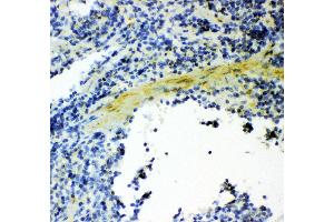 Anti- Gelsolin antibody, IHC(P) IHC(P): Mouse Spleen Tissue (Gelsolin antibody  (AA 580-782))