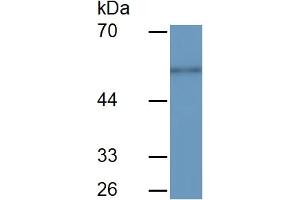 Western Blotting (WB) image for Serpin Peptidase Inhibitor, Clade G (C1 Inhibitor), Member 1 (SERPING1) ELISA Kit (ABIN6730925)