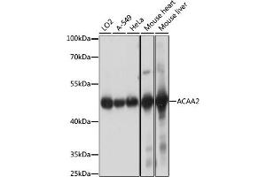 Western blot analysis of extracts of various cell lines, using  antibody (ABIN7265368) at 1:1000 dilution. (ACAA2 antibody  (AA 1-250))
