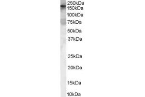 Image no. 1 for anti-rho Guanine Nucleotide Exchange Factor (GEF) 5 (ARHGEF5) (Internal Region) antibody (ABIN374647) (ARHGEF5 antibody  (Internal Region))