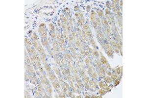 Immunohistochemistry of paraffin-embedded mouse stomach using BGLAP antibody (ABIN5975009) at dilution of 1/100 (40x lens). (Osteocalcin antibody)