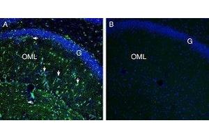 Expression of Secretin Receptor in rat hippocampus - Immunohistochemical staining of perfusion-fixed frozen rat brain sections with Anti-Secretin Receptor (extracellular) Antibody (ABIN7043607, ABIN7044414 and ABIN7044415), (1:200), followed by goat anti-rabbit-AlexaFluor-488. (SCTR antibody  (Extracellular, N-Term))