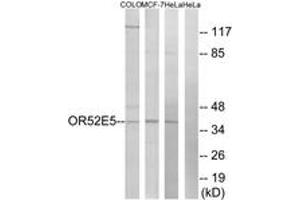 Western blot analysis of extracts from COLO/MCF-7/HeLa cells, using OR52E5 Antibody. (OR52E5 antibody  (AA 199-248))