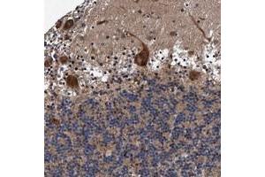 Immunohistochemical staining of human cerebellum with AGAP2 polyclonal antibody  shows distinct cytoplasmic positivity in Purkinje cells.