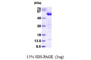 SDS-PAGE (SDS) image for Testis Derived Transcript (3 LIM Domains) (TES) (AA 1-421) protein (His tag) (ABIN667812)