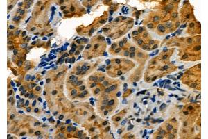 ABIN6264138 and ABIN6273148 at 1/100 staining Rat kidney tissue by IHC-P. (PER2 antibody  (Internal Region))