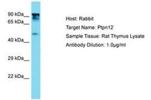 Image no. 1 for anti-Protein Tyrosine Phosphatase G1 (PTPN12) (AA 591-640) antibody (ABIN6750360) (PTPN12 antibody  (AA 591-640))