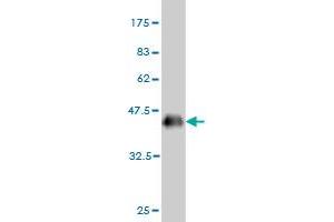 Western Blot detection against Immunogen (36. (CSNK1G1 antibody  (AA 293-393))