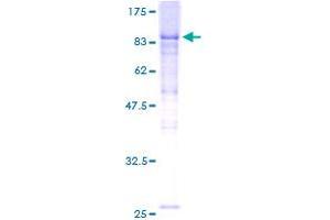 Kelch Repeat and BTB (POZ) Domain Containing 2 (KBTBD2) (AA 1-623) protein (GST tag)