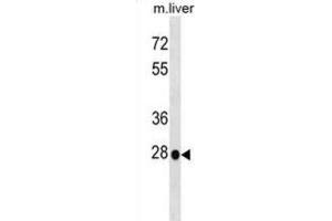 Western Blotting (WB) image for anti-Homeobox B5 (HOXB5) antibody (ABIN2999364) (HOXB5 antibody)