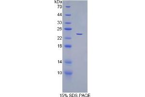 SDS-PAGE analysis of Human CDC25B Protein. (CDC25B Protein)