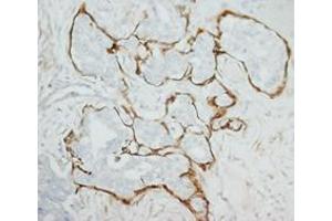 MMP2 Polyclonal Antibody (MMP2 antibody  (C-Term))