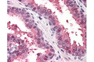 Anti-RAD23B antibody IHC of human prostate. (RAD23B antibody  (AA 163-176))