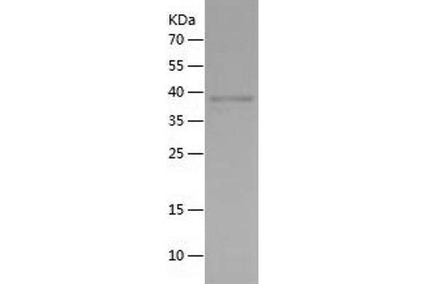 SIRT1 Protein (AA 510-747) (His tag)