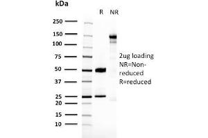 SDS-PAGE (SDS) image for anti-14-3-3 epsilon (YWHAE) antibody (ABIN6940908)